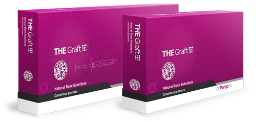 graft-box-500px