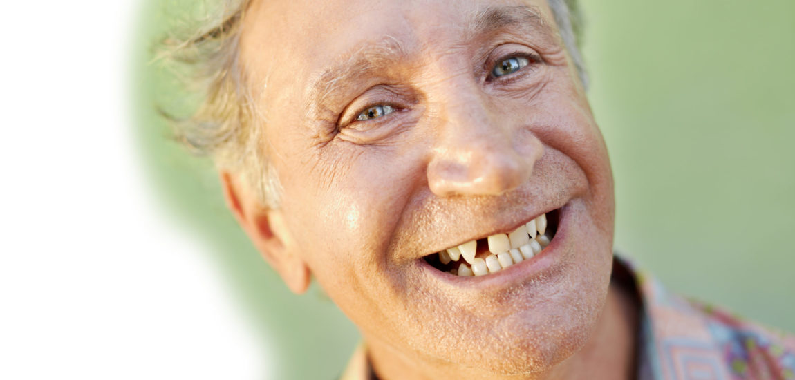 aged toothless man smiling at camera portrait of senior caucasian man with dental problems showing missing tooth and smiling. Horizontal shape, copy space