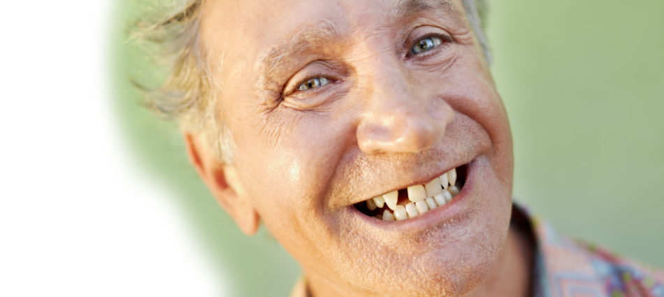 portrait of senior caucasian man with dental problems showing missing tooth and smiling. Horizontal shape, copy space