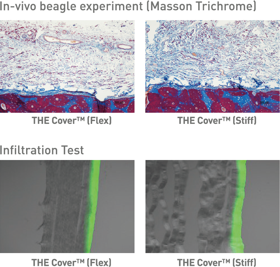 THE_Cover_invivo-infiltration-test (1)